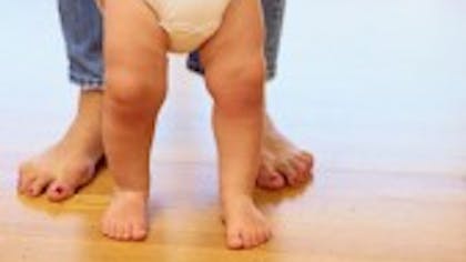 Mon Enfant Marche Mal Dois Je M Inquieter Dossier Familial Mon Enfant Marche Mal Dois Je M Inquieter Dossier Familial