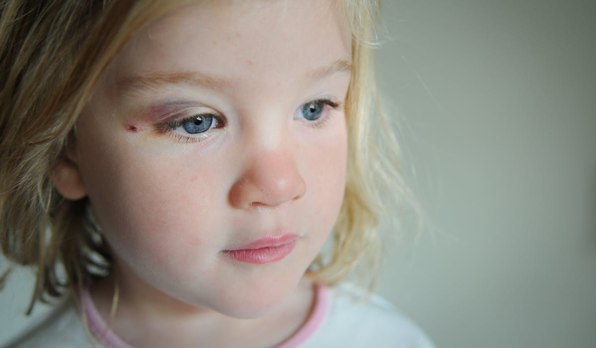 Un recensement des enfants morts à la suite de violences intrafamiliales sera publié chaque année. Un recensement des enfants morts à la suite de violences intrafamiliales sera publié chaque année.
