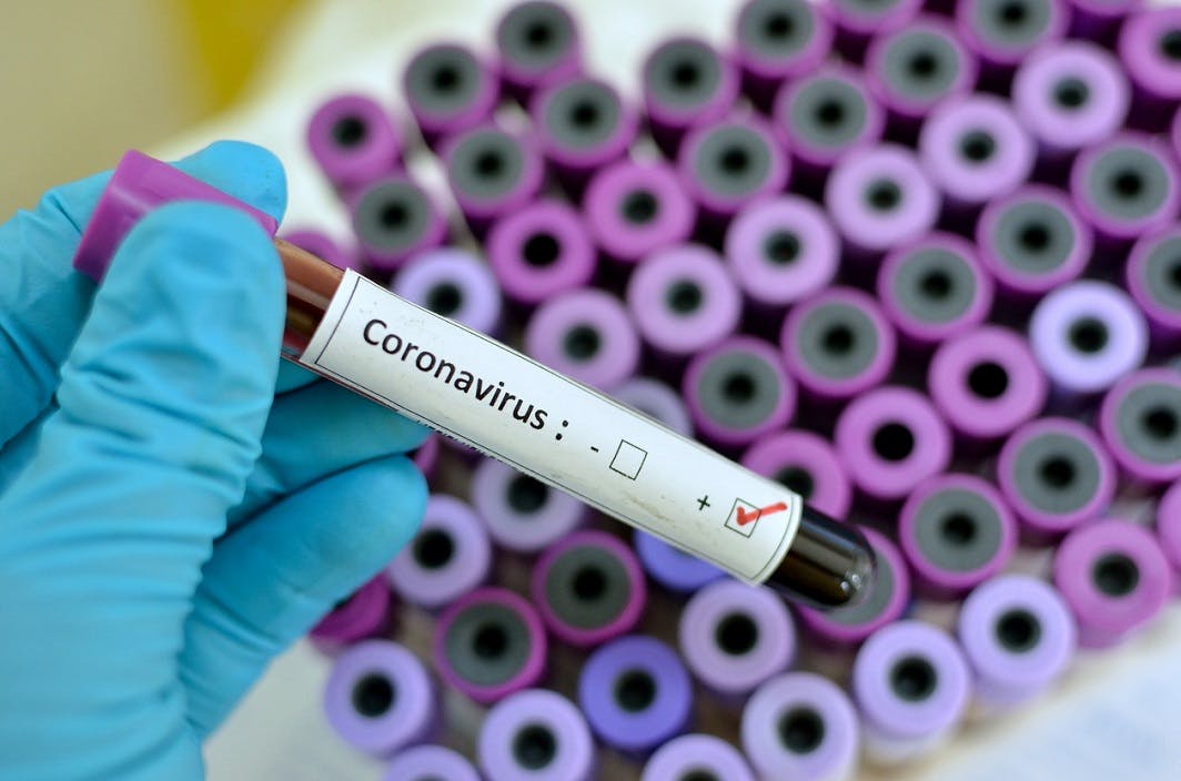 COVID-19: Un vaccin expérimental a été testé chez l'homme COVID-19: Un vaccin expérimental a été testé chez l'homme