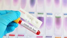 Tests coronavirus : la liste des laboratoires pour faire un test (prise en charge 100 %)