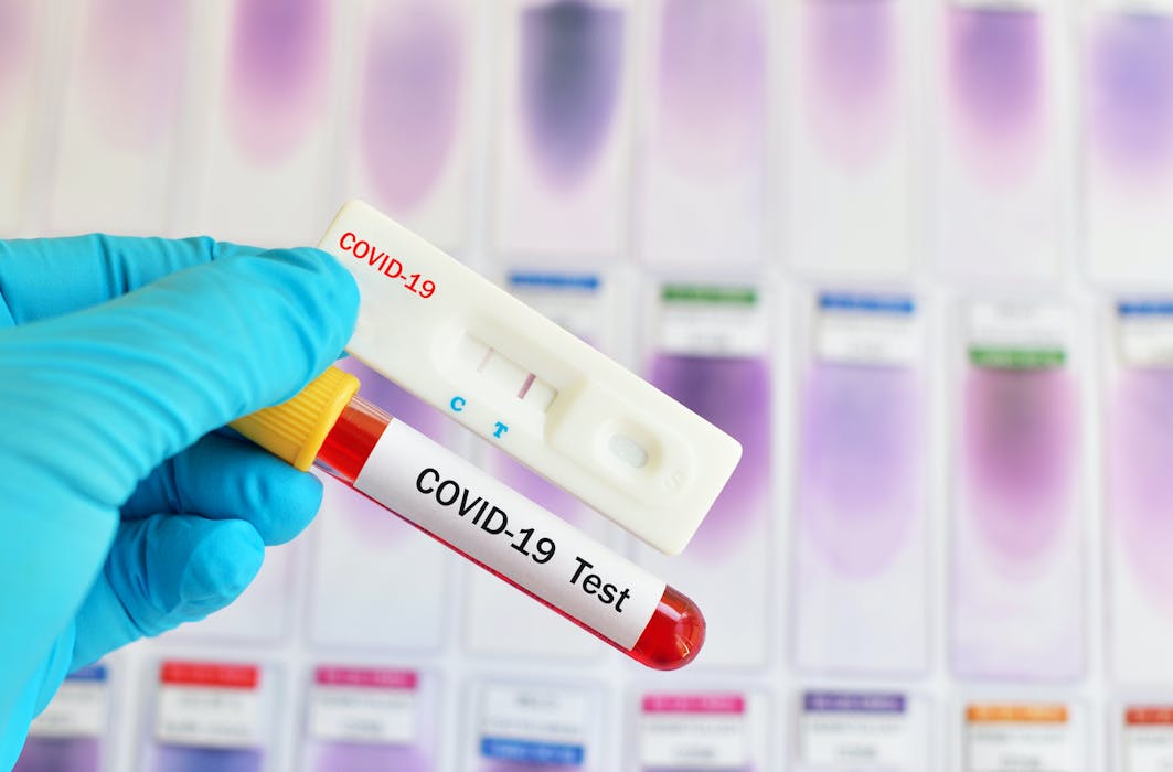 Coronavirus : comment faire un test de dépistage au Covid ...