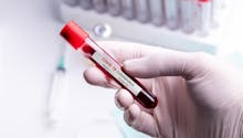 Coronavirus : certains tests sérologiques sont désormais remboursés