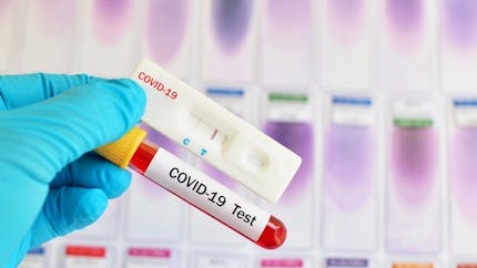Coronavirus : les pharmacies sont autorisées à réaliser des tests sérologiques rapides
