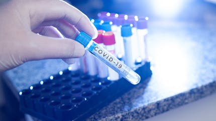 Tests salivaires du Covid-19 : êtes-vous prioritaire ?