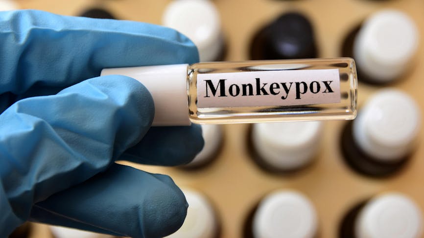 Tube Monkeypox
